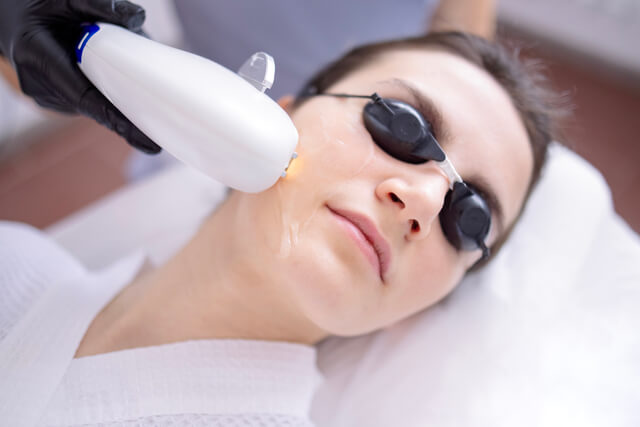Woman receiving IPL in Hot Springs with protective eyewear and cooling gel during a professional photofacial treatment.