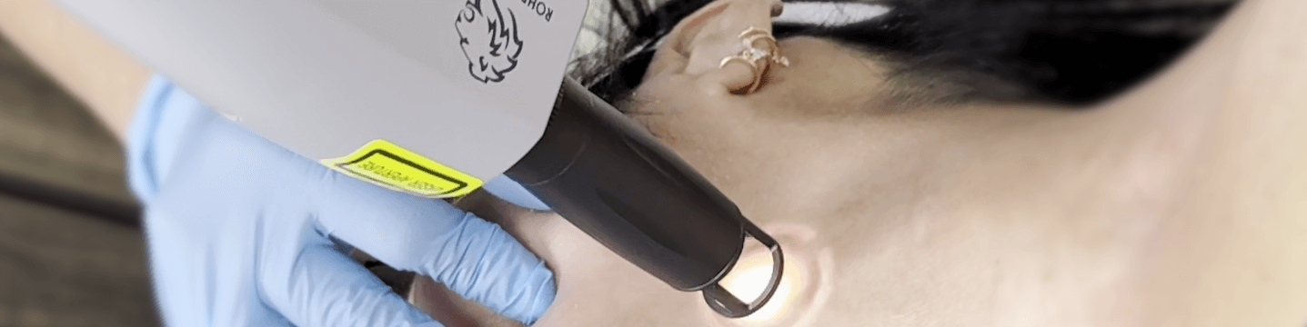 Laser skin resurfacing treatment in Hot Springs using Erbium YAG technology.