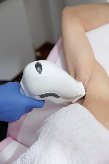 Laser device being used on a woman’s underarm during a hair removal treatment at Embrace Eternal Beauty in Hot Springs AR.